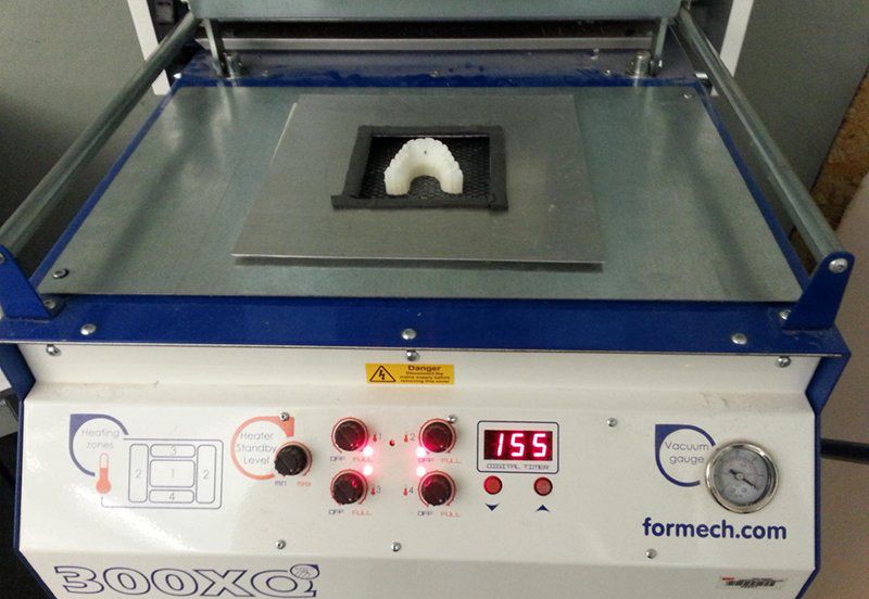 跟高价牙医说再见：男子用3D打印自制牙套