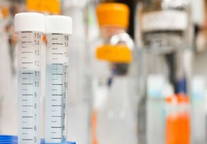 我国科学家发现了可抑制HIV扩散的蛋白质