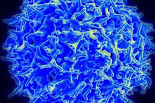 科学家首次记录下HIV通过性传播的全过程