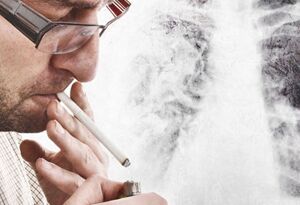 吸烟让你酷酷的?调查发现吸烟会让人变丑